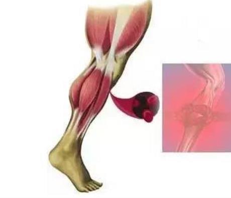 肌肉拉伤能否吃角瓜,肌肉拉伤后的营养补给之道